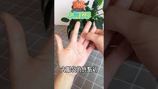 熬夜型眼袋，去無踪影【小穎養生】