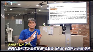 무릎인대 이렇게 다친다! 전방십자인대 파열 자세와 증상