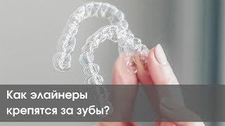 Как держатся элайнеры?