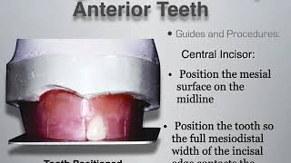 Complete Dentures 1 - 8) Anterior setup