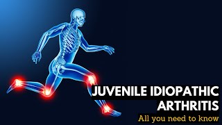 Juvenile Idiopathic Arthritis: Everything You Need To Know