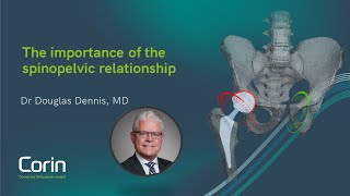 The importance of the spinopelvic relationship - Dr Doug Dennis, MD