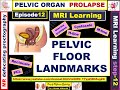 MRI learning 12 Pelvic floor organs prolapse . M&H lines; through MR defecating proctography.