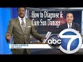 Cultura's Dr. Battle on How to Diagnose and Cure Sun Damage