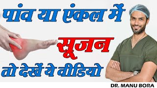 पांव या एंकल में आ रही है सूजन तो देखें ये वीडियो. // Leg or Ankle Swelling // Dr. Manu Bora