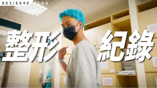 痛下決心去整形！幾十年的痣掰掰了！/ S3E040