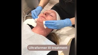 Ultraformer Treatment Video at Dermasurge clinic