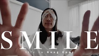 VLOG | 終於去做Smile微笑矯視 / 第一身經歷 到底驚唔驚？ / 一星期康復體驗 心路歷程大公開