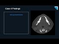 2022 qa forum part 1 review 15 minute radiology cme