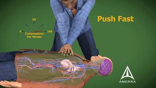 CPR cardiopulmonary resuscitation - 3D animation