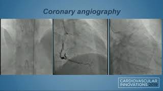 CVI 2019_Thursday, 7/18_ Coronary Challenging Case Competition Semifinals_George Shenoda