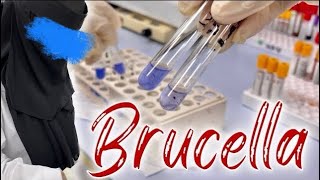 طريقة اختبار البروسيلا | Brucella abortus and Brucella melitensis test