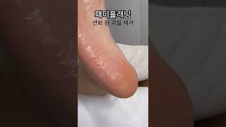 패디플래닝ㅣ 노원 올데이뷰티ㅣ발 각질 관리