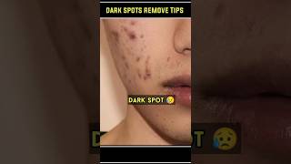 🔥Dark Spots Remove tips | #shorts #darkspots #ytshorts