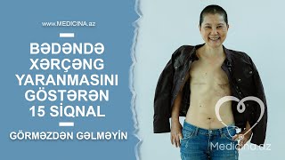 Bədəndə xərçəng yaranmasını göstərən 15 siqnal – Görməzdən gəlməyin