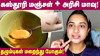 How to get rid of scars? | Home Remedies for Scar Removal