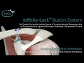 Infinity-Lock™ Button System Surgical Technique Animation