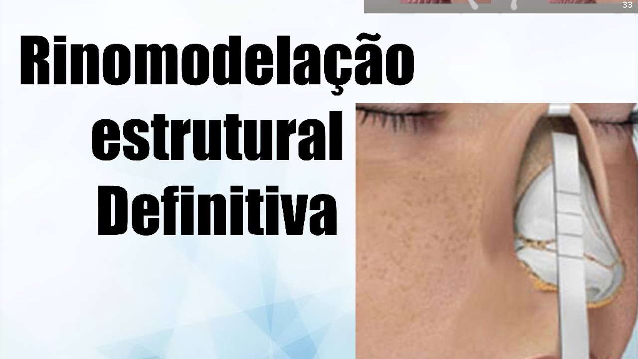 Rinomodelação Estrutural Definitiva. Uma Micro Cirurgia Que Pode ...