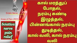 நரம்பு சுண்டி இழுத்தல் | கால் மரத்துப் போதல் | கால் நரம்பு வலி | home remedy for sciatica nerve pain