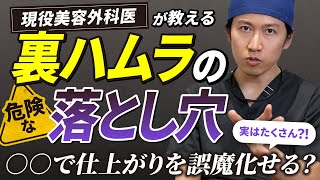 【注意】裏ハムラが再発してしまう危険な落とし穴。原因や対策などを解説します