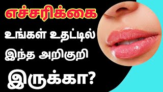 உங்கள் உதட்டில் இந்த அறிகுறி இருக்கா? உஷார்