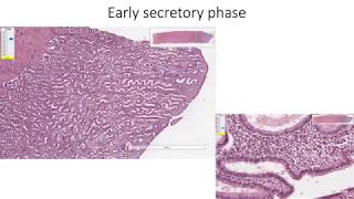 Histology with Chimmalgi: Uterus