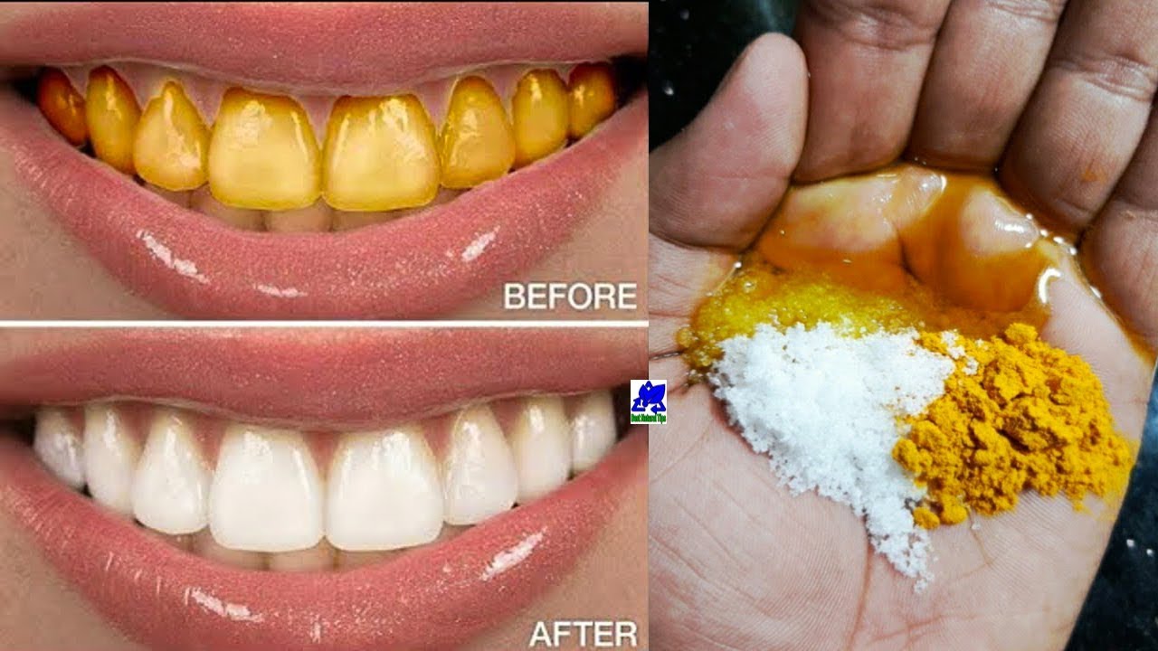 HOW TO WHITEN YOUR YELLOW TEETH NATURALLY AT HOME IN JUST 2/3 MINUTES ...