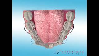 ScreenPlay Orthodontic Education Videos: Dynaflex MSX 2000