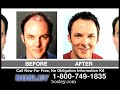 clinically proven permanent hair loss solutions from bosley