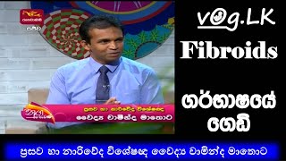 ගර්භාෂයේ ගෙඩි හඳුනා ගන්නේ කෙස්ද? නුගසෙවණ 2022.06.02 ප්‍රසව හා නාරිවේද විශේෂඥ වෛද්‍ය චාමින්ද මාතොට