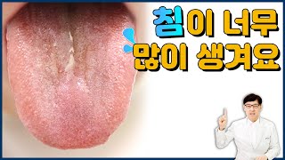 유연증/ 침이 너무 많이 생겨요