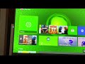 Xbox Series X/S: How to Fix Error “0x80820011” Occurs When Accessing Microsoft Store Tutorial! (2021