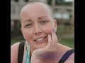 Lisa's story - living and dying with cancer