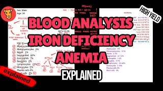 Blood Analysis in Iron deficiency anemia. Iron studies test.