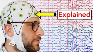 EEG (Electroencephalogram) Explained