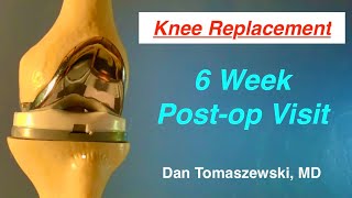 6 Week Post Op Visit after Knee Replacement
