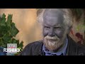 Why This Man’s Skin Turned Blue