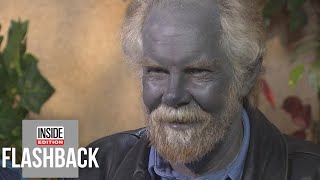 Why This Man’s Skin Turned Blue