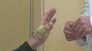 Man gets toe to finger surgery