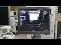 siemens s2000 part 4 elastography