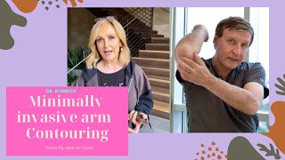 Minimally Invasive Arm Contouring featuring Jane McGarry