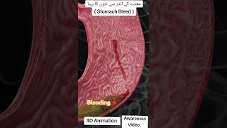 Shocking Blood Flow in Stomach! 🩸😱\