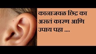 कानाजवळ छिद्र का असतं कारण आणि उपाय पहा - Why Hole At Top of Ear