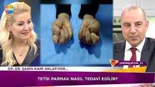 Tetik parmak nasıl tedavi edilir?