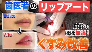 歯医者で施術する「デンタルリップアート」ですっぴんでも血色感UP！メイク時短に！【名古屋あおい歯科・矯正歯科】