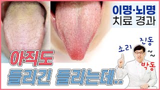 동의보감 뇌명증, 이명증 치료 효과를 느낄 때 환자들이 많이 하는 말은?