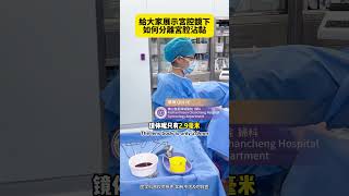 子宮腔鏡下的子宮腔沾黏手術Hysteroscopic surgery for intrauterine adhesions