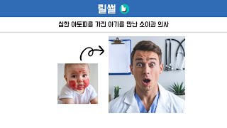 심한 아토피를 가진 아기를 만난 소아과 의사 썰