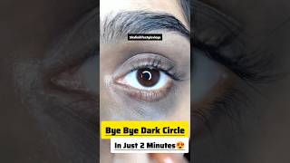 Remove Dark Circles Natural At Home🏡✨/Dark Circle Remove👁️/#darkcircles #diy #shorts #ytshorts