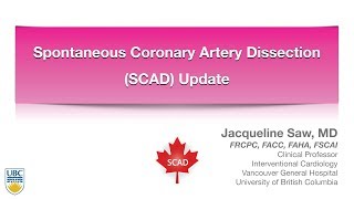 Update on Spontaneous Coronary Artery Dissection, September 15  2017